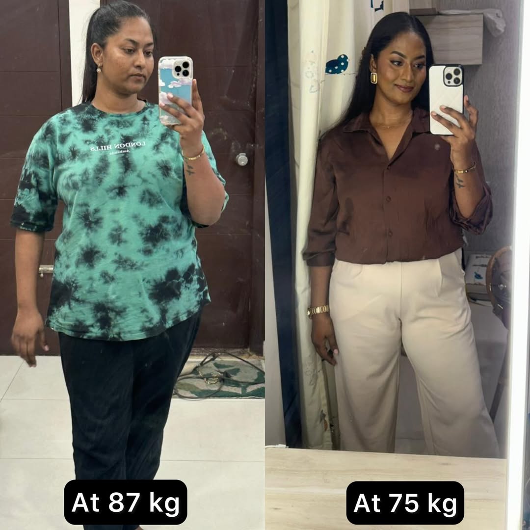 Best dietician in Chicago transformation - before and after weight loss